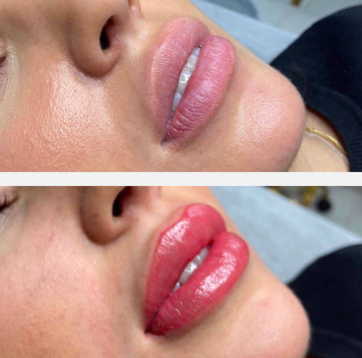 Lipblush results